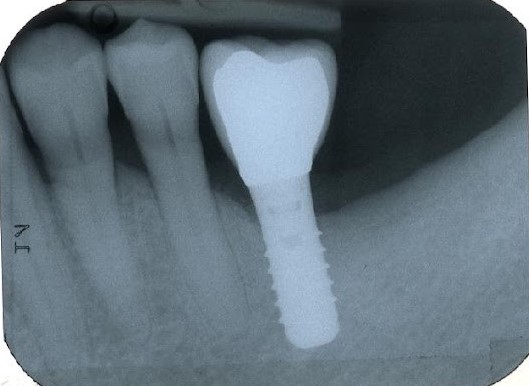 The 2D radiograph
